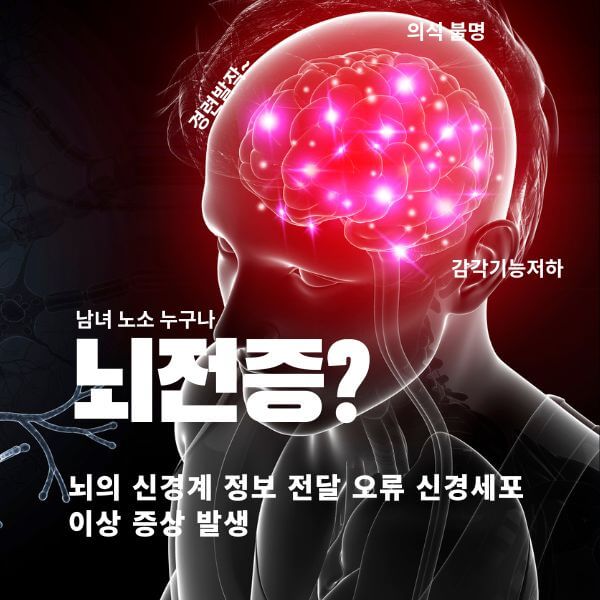 뇌전증 증상과 원인 예방법과 치료
