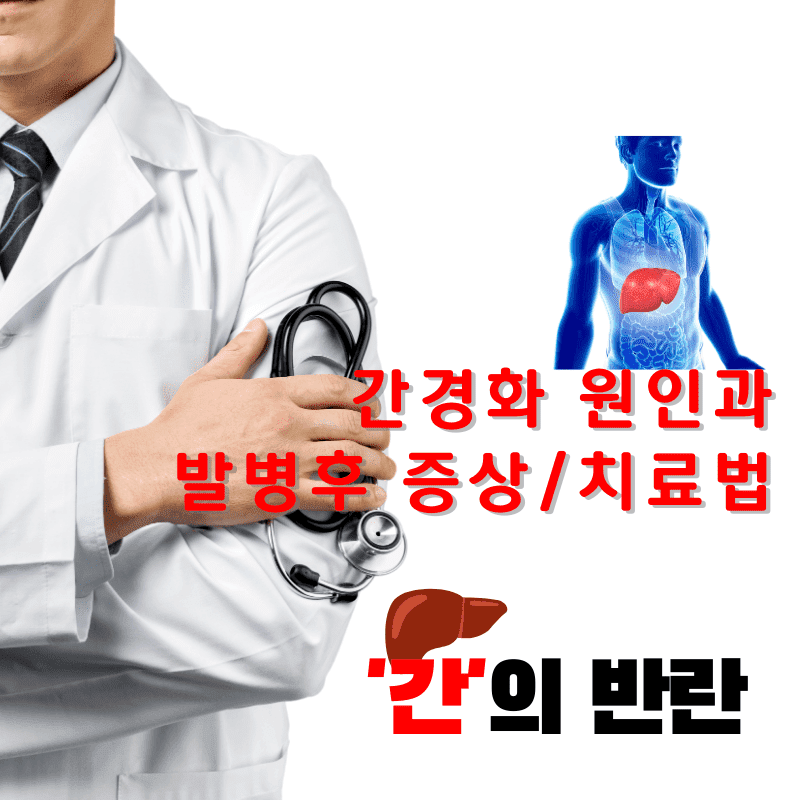 간경화 원인과 발병후 증상 및 치료법